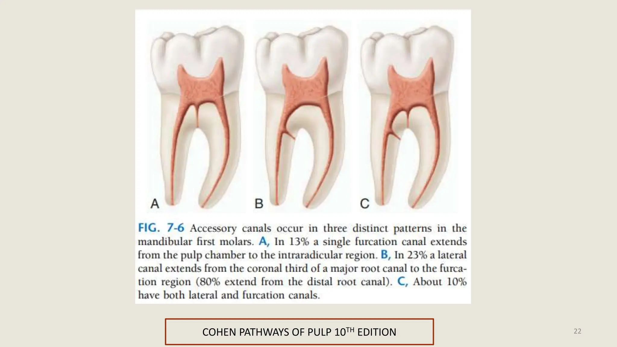 INTERNAL ANATOMY OF PERMANENT TOOTH - Endodontic approaches. | PPTX