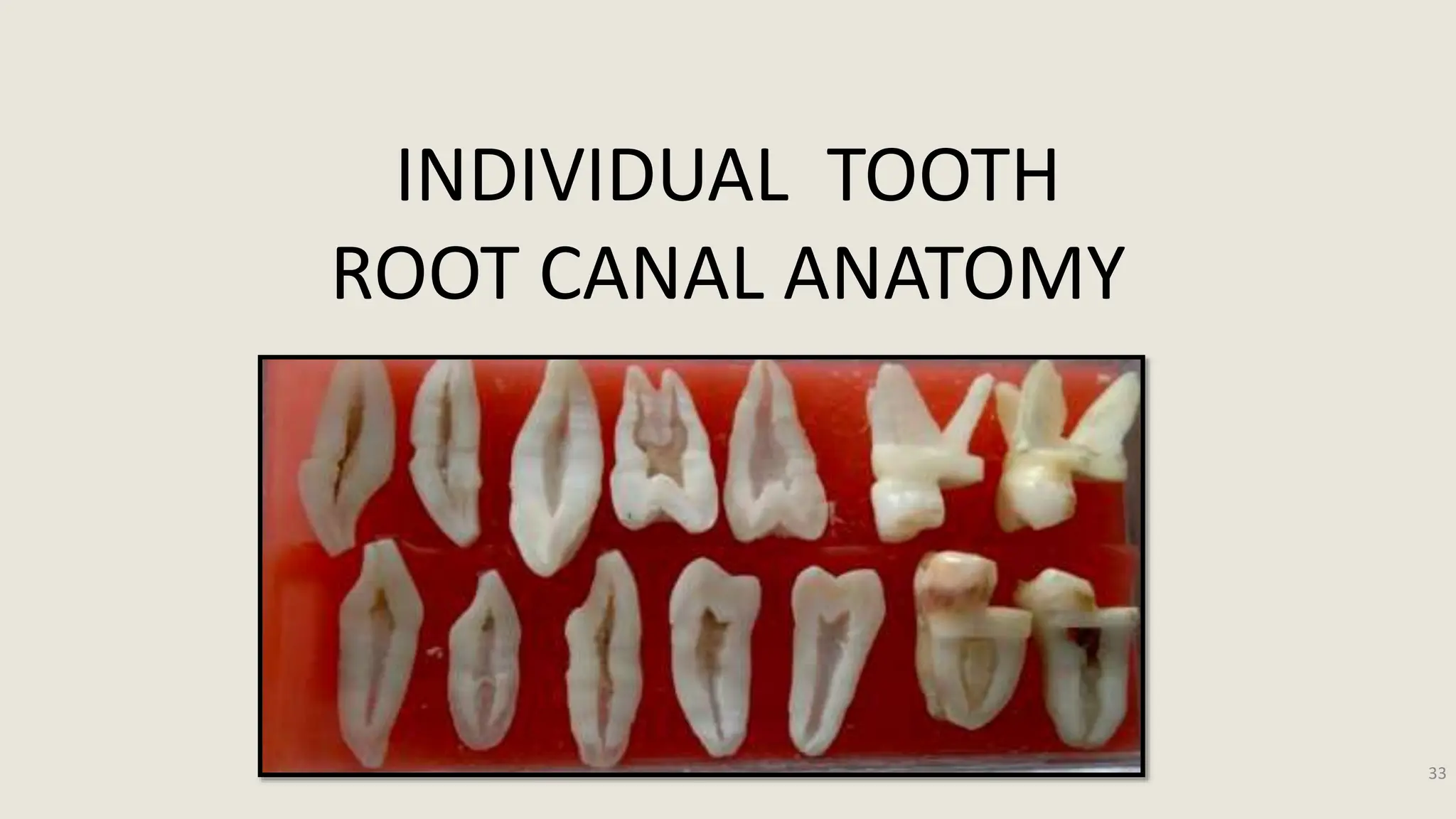 INTERNAL ANATOMY OF PERMANENT TOOTH - Endodontic approaches. | PPTX
