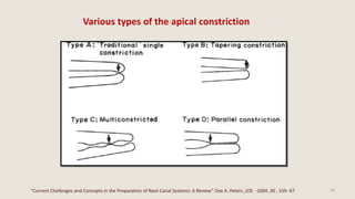 INTERNAL ANATOMY OF PERMANENT TOOTH - Endodontic approaches. | PPTX