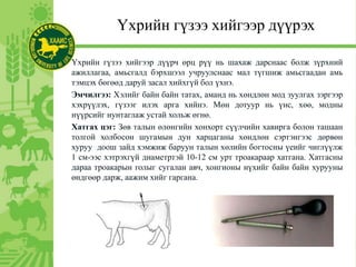 Үхрийн гүзээ хийгээр дүүрэх
Үхрийн гүзээ хийгээр дүүрч өрц рүү нь шахаж дарснаас болж зүрхний
ажиллагаа, амьсгалд бэрхшээл учруулснаас мал түгшиж амьсгаадан амь
тэмцэх бөгөөд даруй засал хийхгүй бол үхнэ.
Эмчилгээ: Хэлийг байн байн татах, аманд нь хөндлөн мод зуулгах зэргээр
хэхрүүлэх, гүзээг илэх арга хийнэ. Мөн дотуур нь үнс, хөө, модны
нүүрсийг нунтаглаж устай хольж өгнө.
Хатгах цэг: Зөв талын өлөнгийн хонхорт сүүлчийн хавирга болон ташаан
толгой холбосон шугамын дун харцаганы хөндлөн сэртэнгээс дөрвөн
хуруу доош зайд хэмжиж баруун талын хөлийн богтосны үеийг чиглүүлж
1 см-ээс хэтрэхгүй диаметртэй 10-12 см урт троакараар хатгана. Хатгасны
дараа троакарын голыг сугалан авч, хонгионы нүхийг байн байн хурууны
өндгөөр дарж, аажим хийг гаргана.
 