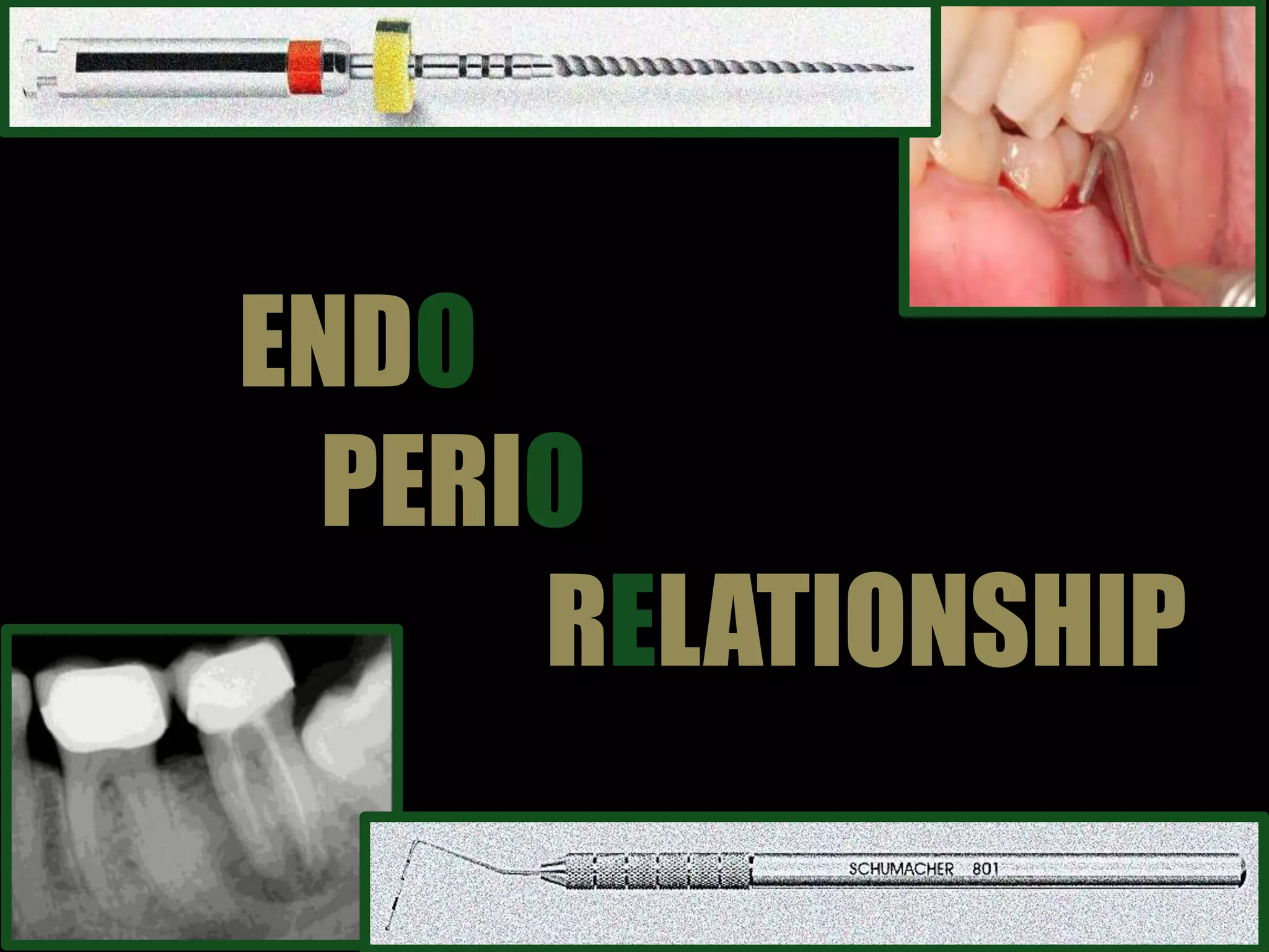 Endodontic Periodontal Relationship, ENDO PERIO LESION PPT
