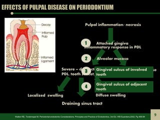 EFFECTS OF PULPAL DISEASE ON PERIODONTIUM
Pulpal inflammation/ necrosis
Inflammatory response in PDL
Minimal response
conf...