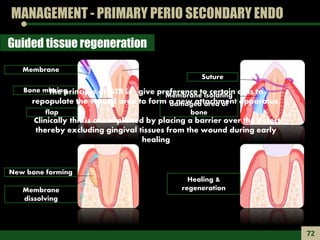 MANAGEMENT - PRIMARY PERIO SECONDARY ENDO
Guided tissue regeneration
Membrane
Bone missing
flap
Suture
Membrane isolating
...