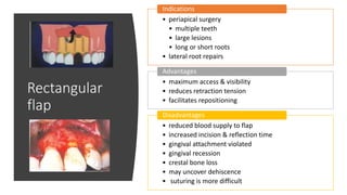 Rectangular
flap
• periapical surgery
• multiple teeth
• large lesions
• long or short roots
• lateral root repairs
Indications
• maximum access & visibility
• reduces retraction tension
• facilitates repositioning
Advantages
• reduced blood supply to flap
• increased incision & reflection time
• gingival attachment violated
• gingival recession
• crestal bone loss
• may uncover dehiscence
• suturing is more difficult
Disadvantages
 