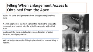 Filling When Enlargement Access Is
Obtained from the Apex
access for canal enlargement is from the apex: very sclerotic
canal
A 5 mm segment is cut from a small file, held in the beaks of a
hemostat, and pushed into the apical foramen to widen that
area
location of the canal,initial enlargement, location of apical
foramen, canal preparation
well packed gutta-percha filling is placed and no reverse filling is
needed.
 