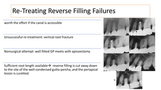 Re-Treating Reverse Filling Failures
worth the effort if the canal is accessible
Unsuccessful re-treatment: vertical root fracture
Nonsurgical attempt: well fitted GP meets with apicoectomy
Sufficient root length available reverse filling is cut away down
to the site of the well-condensed gutta-percha, and the periapical
lesion is curetted.
 