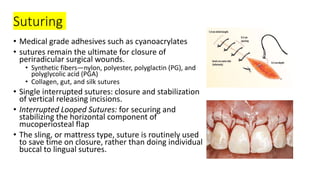 Suturing
• Medical grade adhesives such as cyanoacrylates
• sutures remain the ultimate for closure of
periradicular surgical wounds.
• Synthetic fibers—nylon, polyester, polyglactin (PG), and
polyglycolic acid (PGA)
• Collagen, gut, and silk sutures
• Single interrupted sutures: closure and stabilization
of vertical releasing incisions.
• Interrupted Looped Sutures: for securing and
stabilizing the horizontal component of
mucoperiosteal flap
• The sling, or mattress type, suture is routinely used
to save time on closure, rather than doing individual
buccal to lingual sutures.
 