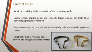 Dr. Nithin Mathew – Contacts & Contours
Contact Rings
101
• Work by providing slight separation of the contacting teeth.
• Spring action applies equal and opposite forces against the teeth thus
providing optimum separation.
• After separation, the composite is incrementally built and cured in a passive
manner.
• Finally, the ring is removed and
the teeth are brought back into contact.
 