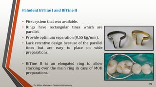 Dr. Nithin Mathew – Contacts & Contours
103
Palodent BiTine I and BiTine II
• First system that was available.
• Rings have rectangular tines which are
parallel.
• Provide optimum separation (0.55 kg/mm).
• Lack retentive design because of the parallel
tines but are easy to place on wide
preparations.
• BiTine II is an elongated ring to allow
stacking over the main ring in case of MOD
preparations.
 