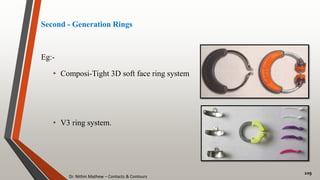 Dr. Nithin Mathew – Contacts & Contours
109
Second - Generation Rings
Eg:-
• Composi-Tight 3D soft face ring system
• V3 ring system.
 
