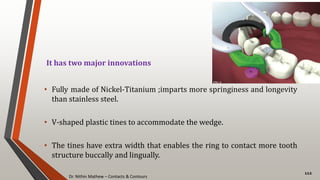 Dr. Nithin Mathew – Contacts & Contours
112
It has two major innovations
• Fully made of Nickel-Titanium ;imparts more springiness and longevity
than stainless steel.
• V-shaped plastic tines to accommodate the wedge.
• The tines have extra width that enables the ring to contact more tooth
structure buccally and lingually.
 