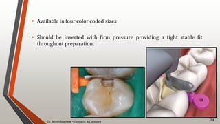 Dr. Nithin Mathew – Contacts & Contours
114
• Available in four color coded sizes
• Should be inserted with firm pressure providing a tight stable fit
throughout preparation.
 