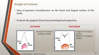 Dr. Nithin Mathew – Contacts & Contours
Height of Contour
15
• Area of greatest circumference on the facial and lingual surface of the
teeth.
• Protects the gingival tissue by preventing food impaction.
ANTERIOR POSTERIOR
Cervical 3rd on facial
& lingual surface
Gingival 3rd on facial
surface
Middle 3rd on lingual
surface
 