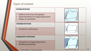 Dr. Nithin Mathew – Contacts & Contours
Types of contour
16
OVERCONTOUR
• Deflects food away from gingiva
• Understimulation of supporting tissues
• Plaque accumulation
UNDERCONTOUR
• Irritation to soft tissues
ADEQUATE CONTOUR
• Stimulation of supporting tissues
• Healthy peridontium
 