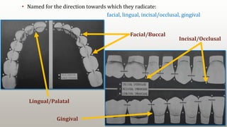 18
• Named for the direction towards which they radicate:
facial, lingual, incisal/occlusal, gingival
Lingual/Palatal
Facial/Buccal
Incisal/Occlusal
Gingival
 