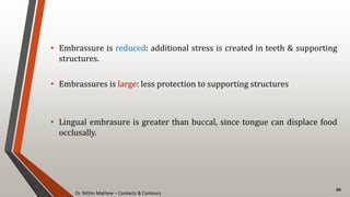 Dr. Nithin Mathew – Contacts & Contours
20
• Embrassure is reduced: additional stress is created in teeth & supporting
structures.
• Embrassures is large: less protection to supporting structures
• Lingual embrasure is greater than buccal, since tongue can displace food
occlusally.
 