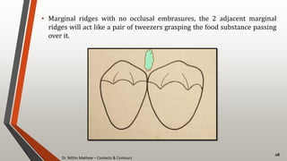 Dr. Nithin Mathew – Contacts & Contours
28
• Marginal ridges with no occlusal embrasures, the 2 adjacent marginal
ridges will act like a pair of tweezers grasping the food substance passing
over it.
 