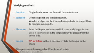 Dr. Nithin Mathew – Contacts & Contours
40
Wedging method:
• Location : Gingival embrasure just beneath the contact area.
• Selection : Depending upon the clinical situation.
: Wooden wedges can be trimmed using a knife or scalpel blade
to produce a custom fit.
• Placement : From the lingual embrasure which is normally larger in size.
: But if it interferes with the tongue it may be placed from the
buccal side.
• Length : ½” or 1.3cm so that it does not irritate the tongue or the
cheek.
• After placement the wedge should be firm and stable.
 