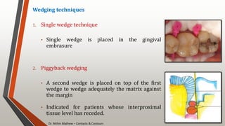 Dr. Nithin Mathew – Contacts & Contours
41
Wedging techniques
1. Single wedge technique
• Single wedge is placed in the gingival
embrasure
2. Piggyback wedging
• A second wedge is placed on top of the first
wedge to wedge adequately the matrix against
the margin
• Indicated for patients whose interproximal
tissue level has receded.
 