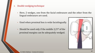 Dr. Nithin Mathew – Contacts & Contours
42
3. Double wedging technique
• Here, 2 wedges, one from the facial embrasure and the other from the
lingual embrasure are used.
• Used when proximal box is wide faciolingually.
• Should be used only if the middle 2/3rd of the
proximal margins can be adequately wedged.
 
