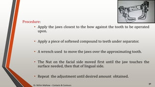 Dr. Nithin Mathew – Contacts & Contours
50
Procedure:
• Apply the jaws closest to the bow against the tooth to be operated
upon.
• Apply a piece of softened compound to teeth under separator.
• A wrench used to move the jaws over the approximating tooth.
• The Nut on the facial side moved first until the jaw touches the
surface needed, then that of lingual side.
• Repeat the adjustment until desired amount obtained.
 