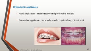 Dr. Nithin Mathew – Contacts & Contours
56
Orthodontic appliances
• Fixed appliances – most effective and predictable method
• Removable appliances can also be used – requires longer treatment
 