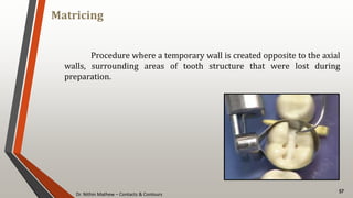 Dr. Nithin Mathew – Contacts & Contours
Matricing
57
Procedure where a temporary wall is created opposite to the axial
walls, surrounding areas of tooth structure that were lost during
preparation.
 