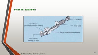 Dr. Nithin Mathew – Contacts & Contours
66
Parts of a Retainer:
 