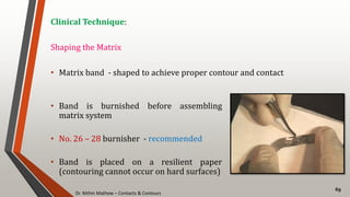 Dr. Nithin Mathew – Contacts & Contours
69
Clinical Technique:
Shaping the Matrix
• Matrix band - shaped to achieve proper contour and contact
• Band is burnished before assembling
matrix system
• No. 26 – 28 burnisher - recommended
• Band is placed on a resilient paper
(contouring cannot occur on hard surfaces)
 