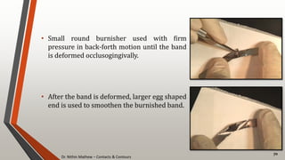 Dr. Nithin Mathew – Contacts & Contours
70
• Small round burnisher used with firm
pressure in back-forth motion until the band
is deformed occlusogingivally.
• After the band is deformed, larger egg shaped
end is used to smoothen the burnished band.
 