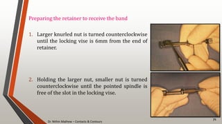 Dr. Nithin Mathew – Contacts & Contours
71
Preparing the retainer to receive the band
1. Larger knurled nut is turned counterclockwise
until the locking vise is 6mm from the end of
retainer.
2. Holding the larger nut, smaller nut is turned
counterclockwise until the pointed spindle is
free of the slot in the locking vise.
 