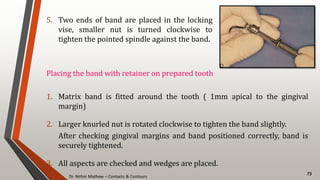 Dr. Nithin Mathew – Contacts & Contours
73
5. Two ends of band are placed in the locking
vise, smaller nut is turned clockwise to
tighten the pointed spindle against the band.
Placing the band with retainer on prepared tooth
1. Matrix band is fitted around the tooth ( 1mm apical to the gingival
margin)
2. Larger knurled nut is rotated clockwise to tighten the band slightly.
After checking gingival margins and band positioned correctly, band is
securely tightened.
3. All aspects are checked and wedges are placed.
 