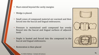 Dr. Nithin Mathew – Contacts & Contours
83
• Must extend beyond the cavity margins
• Wedge is placed.
• Small cones of compound material are warmed and then
forced into the buccal and lingual embrasures.
• Pressure is maintained until compound has evenly
flowed into the buccal and lingual surfaces of adjacent
teeth
• Staple is heated and forced into the compound in the
buccal and lingual embrasures.
• Restoration is then placed
 