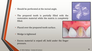 Dr. Nithin Mathew – Contacts & Contours
95
• Should be perforated at the incisal angle.
• The prepared tooth is partially filled with the
restorative material while the matrix is completely
filled.
• Placed over the prepared tooth surface.
• Wedge is tightened
• Excess material is wiped off, held under the finger
pressure.
 