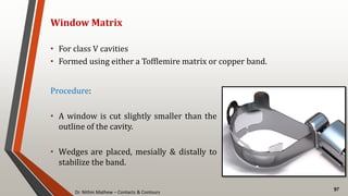Dr. Nithin Mathew – Contacts & Contours
97
Window Matrix
• For class V cavities
• Formed using either a Tofflemire matrix or copper band.
Procedure:
• A window is cut slightly smaller than the
outline of the cavity.
• Wedges are placed, mesially & distally to
stabilize the band.
 