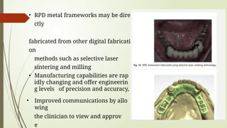 SEMINAR recent advances in Removable partial denture | PPTX