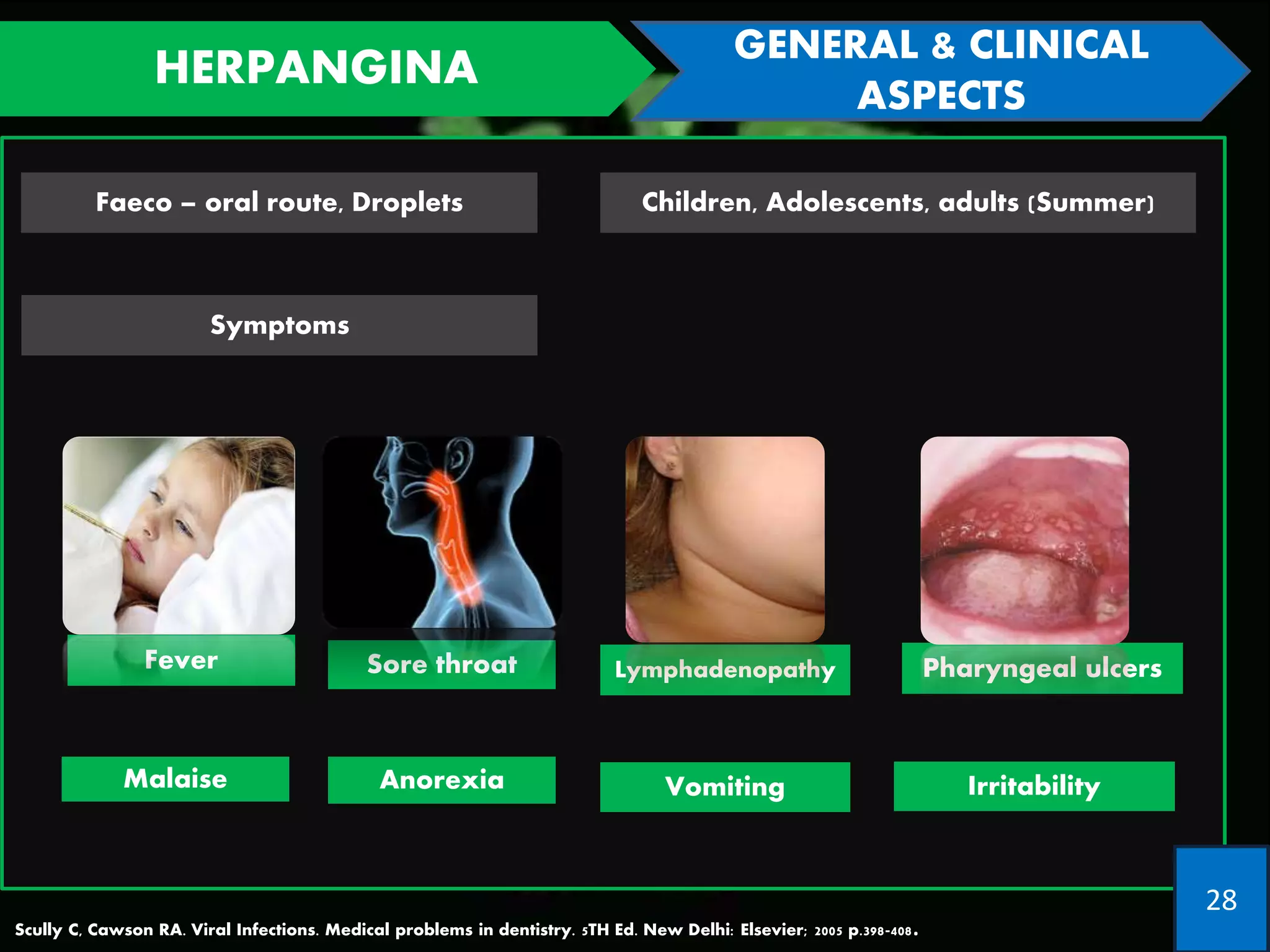Fungal & Viral Infections Of The Oral Cavity, FUNGAL INFECTIONS, VIRAL ...