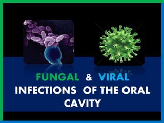 FUNGAL & VIRAL
INFECTIONS OF THE ORAL
CAVITY
 