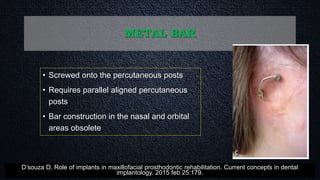 METAL BAR
• Screwed onto the percutaneous posts
• Requires parallel aligned percutaneous
posts
• Bar construction in the nasal and orbital
areas obsolete
D’souza D. Role of implants in maxillofacial prosthodontic rehabilitation. Current concepts in dental
implantology. 2015 feb 25:179.
 