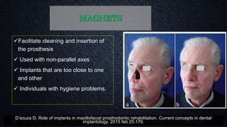MAGNETS
Facilitate cleaning and insertion of
the prosthesis
 Used with non-parallel axes
 Implants that are too close to one
and other
 Individuals with hygiene problems.
D’souza D. Role of implants in maxillofacial prosthodontic rehabilitation. Current concepts in dental
implantology. 2015 feb 25:179.
 