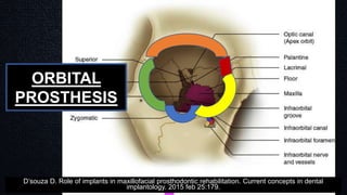 ORBITAL
PROSTHESIS
D’souza D. Role of implants in maxillofacial prosthodontic rehabilitation. Current concepts in dental
implantology. 2015 feb 25:179.
 