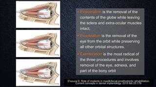 Evisceration is the removal of the
contents of the globe while leaving
the sclera and extra-ocular muscles
intact.
Enucleation is the removal of the
eye from the orbit while preserving
all other orbital structures.
Exenteration is the most radical of
the three procedures and involves
removal of the eye, adnexa, and
part of the bony orbit
D’souza D. Role of implants in maxillofacial prosthodontic rehabilitation.
Current concepts in dental implantology. 2015 feb 25:179.
 