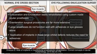 Evisceration and Enucleation easily rehabilitated using custom made
ocular prostheses
Exenteration surgical procedures are far more extensive
Large prostheses do not function well with adhesives or eye glasses
alone
 Application of implants in these large orbital defects reduces the need for
adhesives
D’souza D. Role of implants in maxillofacial prosthodontic rehabilitation. Current concepts in dental
implantology. 2015 feb 25:179.
 