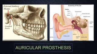AURICULAR PROSTHESIS
 