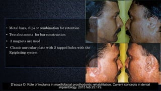 • Metal bars, clips or combination for retention
• Two abutments for bar construction
• 3 magnets are used
• Classic auricular plate with 2 tapped holes with the
Epiplating system
D’souza D. Role of implants in maxillofacial prosthodontic rehabilitation. Current concepts in dental
implantology. 2015 feb 25:179.
 