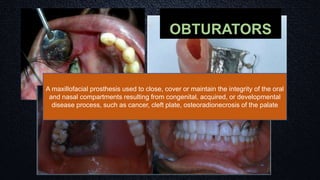 OBTURATORS
A maxillofacial prosthesis used to close, cover or maintain the integrity of the oral
and nasal compartments resulting from congenital, acquired, or developmental
disease process, such as cancer, cleft plate, osteoradionecrosis of the palate
 