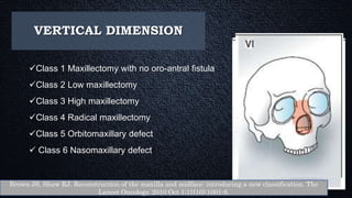 VERTICAL DIMENSION
Class 1 Maxillectomy with no oro-antral fistula
Class 2 Low maxillectomy
Class 3 High maxillectomy
Class 4 Radical maxillectomy
Class 5 Orbitomaxillary defect
 Class 6 Nasomaxillary defect
Brown JS, Shaw RJ. Reconstruction of the maxilla and midface: introducing a new classification. The
Lancet Oncology. 2010 Oct 1;11(10):1001-8.
 