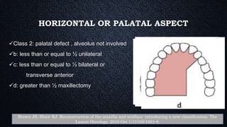 HORIZONTAL OR PALATAL ASPECT
Class 2: palatal defect , alveolus not involved
b: less than or equal to ½ unilateral
c: less than or equal to ½ bilateral or
transverse anterior
d: greater than ½ maxillectomy
Brown JS, Shaw RJ. Reconstruction of the maxilla and midface: introducing a new classification. The
Lancet Oncology. 2010 Oct 1;11(10):1001-8.
 