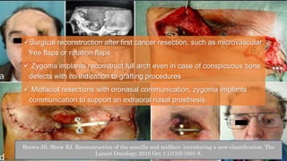 Surgical reconstruction after first cancer resection, such as microvascular
free flaps or rotation flaps
 Zygoma implants reconstruct full arch even in case of conspicuous bone
defects with no indication to grafting procedures
 Midfacial resections with oronasal communication, zygoma implants
communication to support an extraoral nasal prosthesis.
Brown JS, Shaw RJ. Reconstruction of the maxilla and midface: introducing a new classification. The
Lancet Oncology. 2010 Oct 1;11(10):1001-8.
 