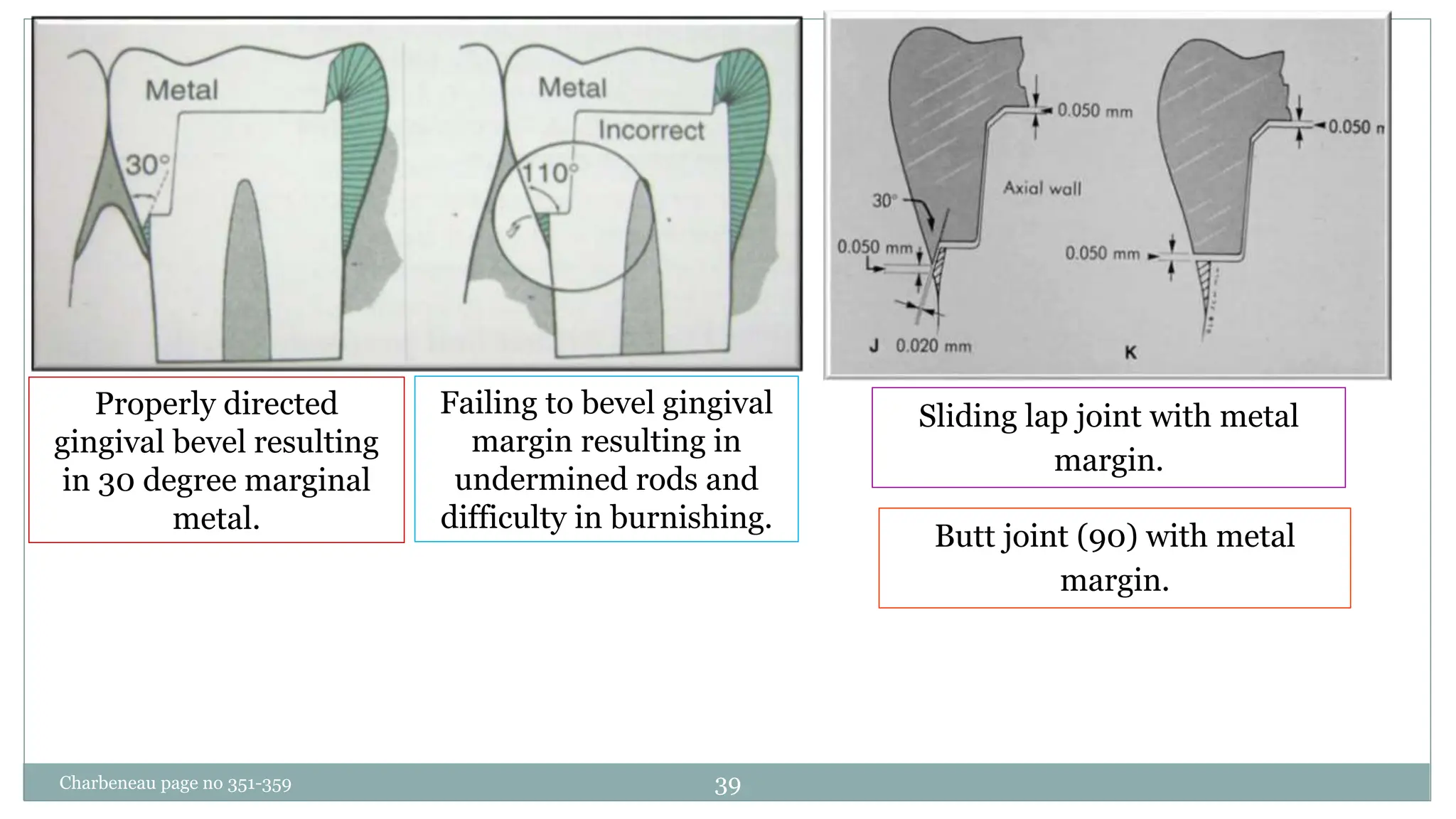CAVITY DESIGNS FOR INLAY. | PPTX